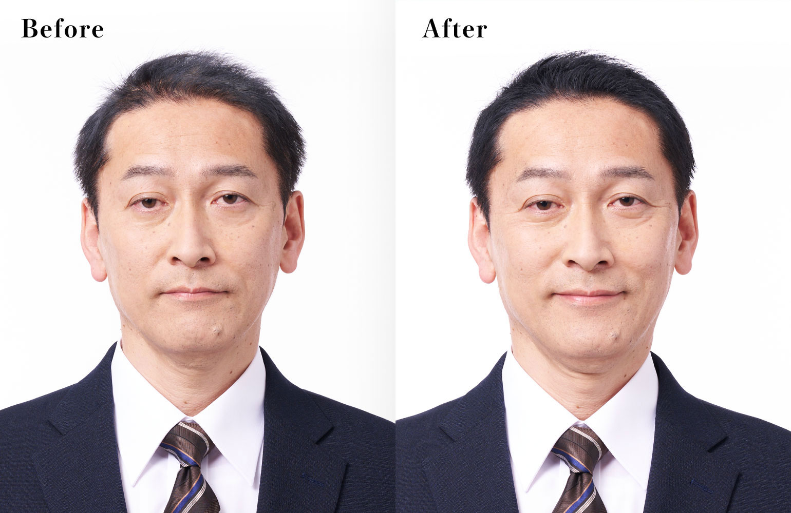 男性に人気！ 柳屋本店 トップシェード スピーディーヘアカバースプレー やや明るめの自然な黒色 150g 4903018215069 fucoa.cl